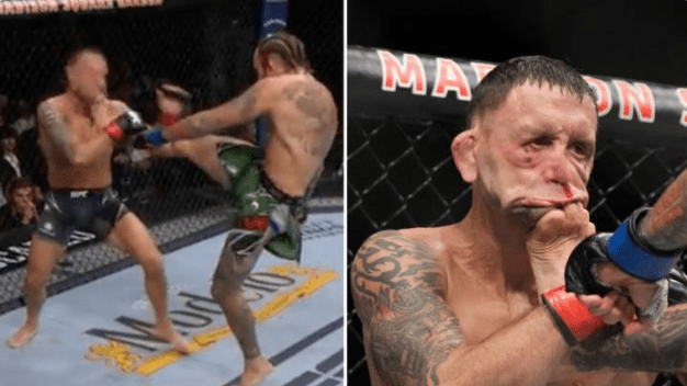 UFC-ის მებრძოლის სახე ბრუტალური დარტყმის შემდეგ | VIDEO